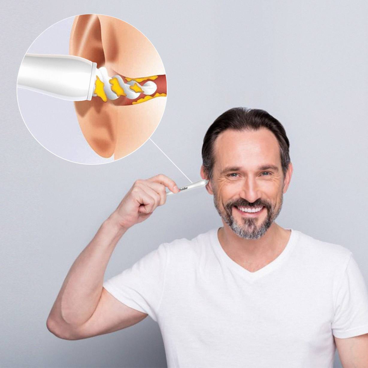 Tvidler For Ear Wax Removal